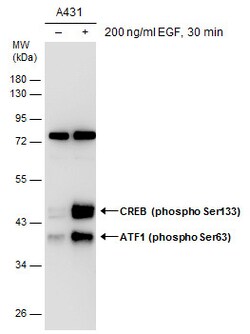 Invitrogen Phospho-ATF1 (Ser63) Polyclonal Antibody 100 &mu;L | Buy Online | Invitrogen&trade; | Fisher Scientific