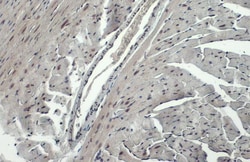 Invitrogen Phospho-ATR (Thr1989) Polyclonal Antibody 100 &mu;L | Buy Online | Invitrogen&trade; | Fisher Scientific