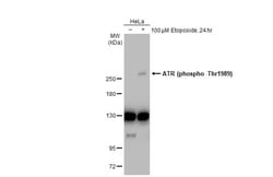 Invitrogen Phospho-ATR (Thr1989) Polyclonal Antibody 100 &mu;L | Buy Online | Invitrogen&trade; | Fisher Scientific
