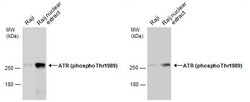 Invitrogen Phospho-ATR (Thr1989) Polyclonal Antibody 100 &mu;L | Buy Online | Invitrogen&trade; | Fisher Scientific