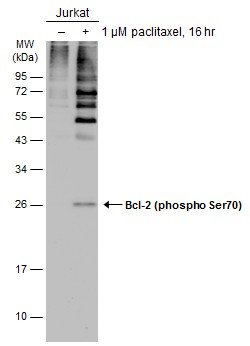 Invitrogen Phospho-Bcl-2 (Ser70) Polyclonal Antibody 100 &mu;L; Unconjugated:Antibodies,