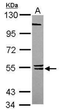 Invitrogen BLK Polyclonal Antibody 100 &mu;L; Unconjugated:Antibodies,