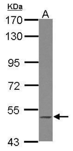Invitrogen BLK Polyclonal Antibody 100 &mu;L; Unconjugated:Antibodies,