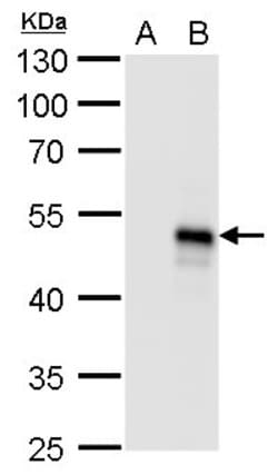 Invitrogen BMP-8B Polyclonal Antibody 100 &mu;L; Unconjugated:Antibodies,