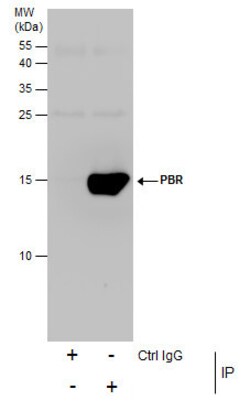 Invitrogen TSPO Polyclonal Antibody 100 &mu;L; Unconjugated:Antibodies,