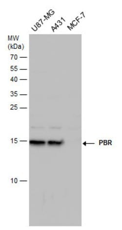 Invitrogen TSPO Polyclonal Antibody 100 &mu;L; Unconjugated:Antibodies,