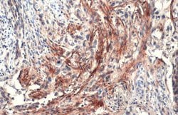 Invitrogen Carbonic Anhydrase IX Polyclonal Antibody 100 &mu;L; Unconjugated:Antibodies,