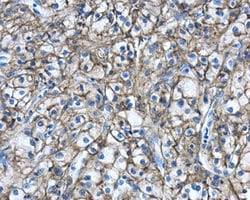Invitrogen Carbonic Anhydrase IX Polyclonal Antibody 100 &mu;L; Unconjugated:Antibodies,