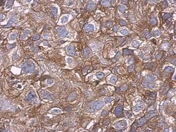 Invitrogen Carbonic Anhydrase IX Polyclonal Antibody 100 &mu;L; Unconjugated:Antibodies,