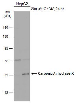 Invitrogen Carbonic Anhydrase IX Polyclonal Antibody 100 &mu;L; Unconjugated:Antibodies,