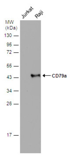 Invitrogen CD79a Polyclonal Antibody 100 μL; Unconjugated:Antibodies,
