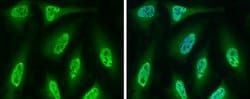 Invitrogen Cdc6 Polyclonal Antibody 100 &mu;L; Unconjugated:Antibodies,