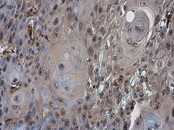 Invitrogen Cdc6 Polyclonal Antibody 100 &mu;L; Unconjugated:Antibodies,