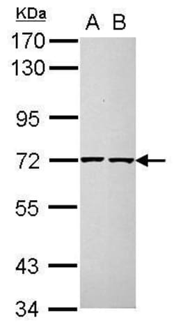 Invitrogen Cdc25A Polyclonal Antibody 100 &mu;L; Unconjugated:Antibodies,