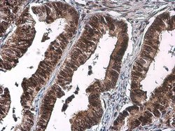 Invitrogen Phospho-CDK2 (Thr160) Polyclonal Antibody 100 &mu;L; Unconjugated:Antibodies,
