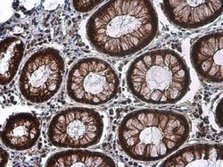 Invitrogen Phospho-CDK2 (Thr160) Polyclonal Antibody 100 &mu;L; Unconjugated:Antibodies,