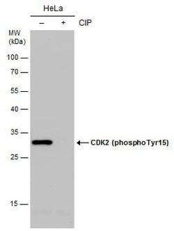 Invitrogen&trade;&nbsp;Phospho-CDK2 (Tyr15) Polyclonal Antibody