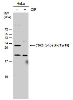 Invitrogen Phospho-CDK5 (Tyr15) Polyclonal Antibody 100 &mu;L; Unconjugated:Antibodies,