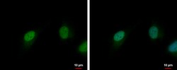 Invitrogen CDK6 Polyclonal Antibody 100 &mu;L; Unconjugated:Antibodies,