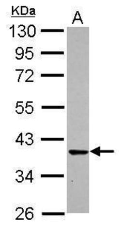 Invitrogen CDK6 Polyclonal Antibody 100 &mu;L; Unconjugated:Antibodies,