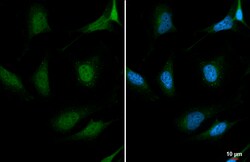 Invitrogen CLK3 Polyclonal Antibody 100 &mu;L; Unconjugated:Antibodies,