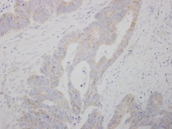 Invitrogen COMT Polyclonal Antibody 100 &mu;L; Unconjugated:Antibodies,