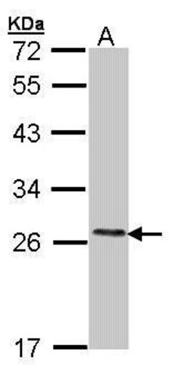 Invitrogen COMT Polyclonal Antibody 100 &mu;L; Unconjugated:Antibodies,