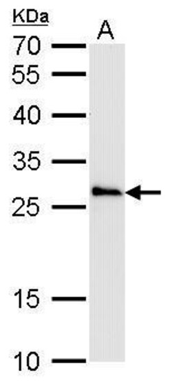 Invitrogen COMT Polyclonal Antibody 100 &mu;L; Unconjugated:Antibodies,