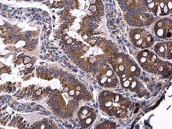 Invitrogen Ceruloplasmin Polyclonal Antibody 100 &mu;L; Unconjugated:Antibodies,