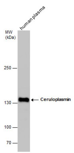 Invitrogen Ceruloplasmin Polyclonal Antibody 100 &mu;L; Unconjugated:Antibodies,