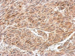 Invitrogen CRMP1 Polyclonal Antibody 100 &mu;L | Buy Online | Invitrogen&trade; | Fisher Scientific