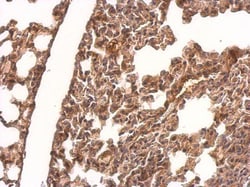 Invitrogen CRMP1 Polyclonal Antibody 100 &mu;L | Buy Online | Invitrogen&trade; | Fisher Scientific