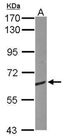 Invitrogen CRMP1 Polyclonal Antibody 100 &mu;L | Buy Online | Invitrogen&trade; | Fisher Scientific