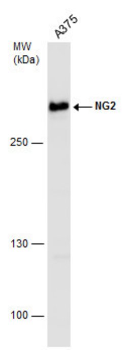 Invitrogen NG2 Polyclonal Antibody 100 &mu;L | Buy Online | Invitrogen&trade; | Fisher Scientific