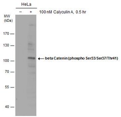Invitrogen Phospho-beta Catenin (Ser33, Ser37, Thr41) Polyclonal Antibody