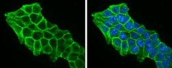 Invitrogen beta Catenin Polyclonal Antibody 100 &mu;L; Unconjugated:Antibodies,