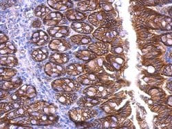 Invitrogen beta Catenin Polyclonal Antibody 100 &mu;L; Unconjugated:Antibodies,