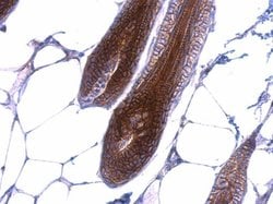 Invitrogen beta Catenin Polyclonal Antibody 100 &mu;L; Unconjugated:Antibodies,