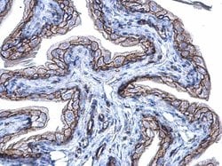 Invitrogen beta Catenin Polyclonal Antibody 100 &mu;L; Unconjugated:Antibodies,