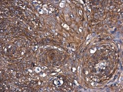 Invitrogen beta Catenin Polyclonal Antibody 100 &mu;L; Unconjugated:Antibodies,