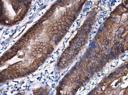 Invitrogen beta Catenin Polyclonal Antibody 100 &mu;L; Unconjugated:Antibodies,