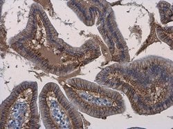 Invitrogen beta Catenin Polyclonal Antibody 100 &mu;L; Unconjugated:Antibodies,