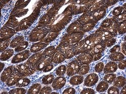 Invitrogen beta Catenin Polyclonal Antibody 100 &mu;L; Unconjugated:Antibodies,