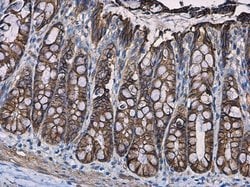Invitrogen beta Catenin Polyclonal Antibody 100 &mu;L; Unconjugated:Antibodies,