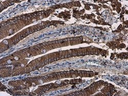 Invitrogen beta Catenin Polyclonal Antibody 100 &mu;L; Unconjugated:Antibodies,