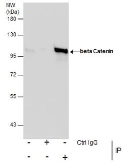 Invitrogen beta Catenin Polyclonal Antibody 100 &mu;L | Buy Online | Invitrogen&trade; | Fisher Scientific