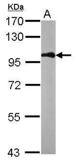 Invitrogen beta Catenin Polyclonal Antibody 100 &mu;L; Unconjugated:Antibodies,