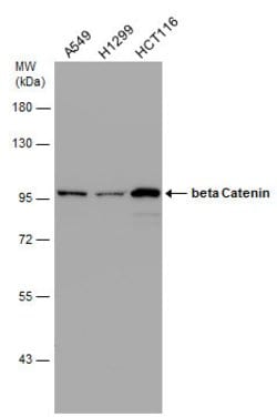 Invitrogen beta Catenin Polyclonal Antibody 100 &mu;L; Unconjugated:Antibodies,