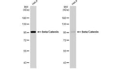 Invitrogen beta Catenin Polyclonal Antibody 100 &mu;L | Buy Online | Invitrogen&trade; | Fisher Scientific