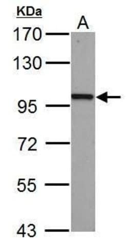 Invitrogen beta Catenin Polyclonal Antibody 100 &mu;L; Unconjugated:Antibodies,
